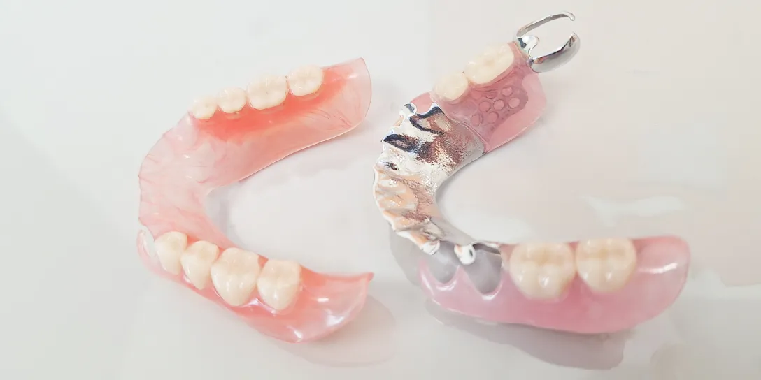 各種義歯（金属床、スマイルデンチャー）